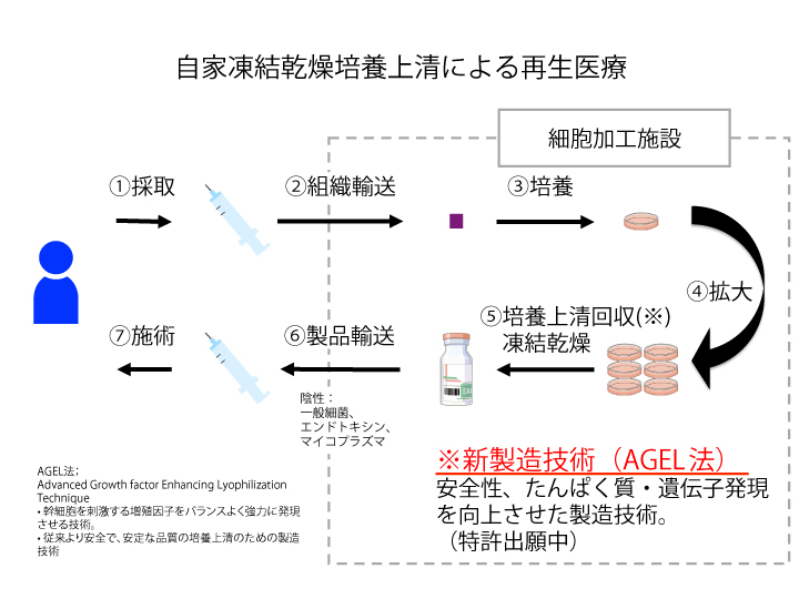 鉄欠乏は勃起不全を引き起こす可能性があります